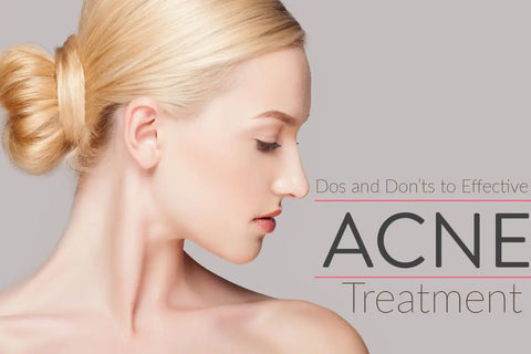 The Truth About Acne And Treatments To Help