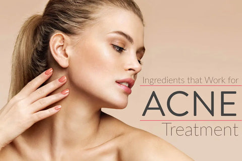 The Truth About Acne And Treatments To Help