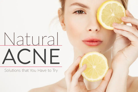 The Truth About Acne And Treatments To Help